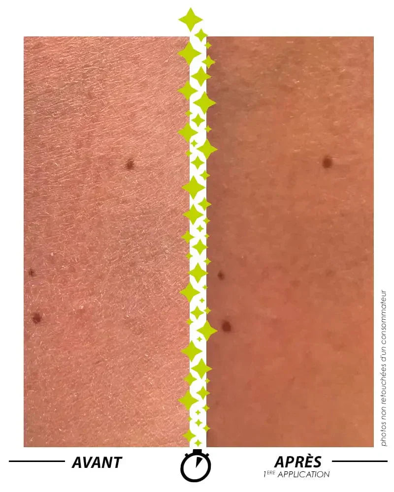 [ Formule ENSORCELANTE ANTI-PEAU DE CROCO ]